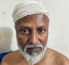 image-here